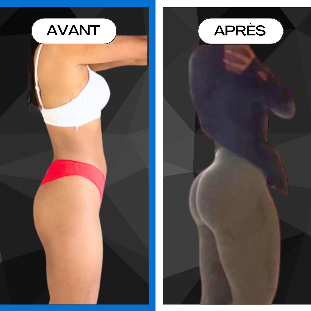 AVANT / APRES Fitty management coach sportif mérignac